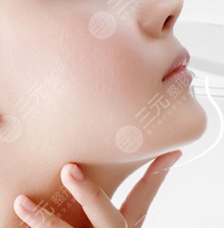 下巴整形要多少錢一針？價(jià)格解析，塑造驚艷輪廓的秘籍分享！