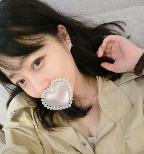 三點定位雙眼皮果圖分享