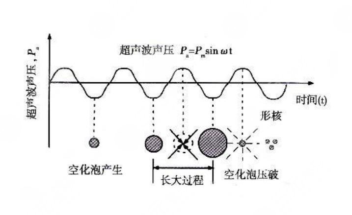 超脂塑術后恢復期是多久?