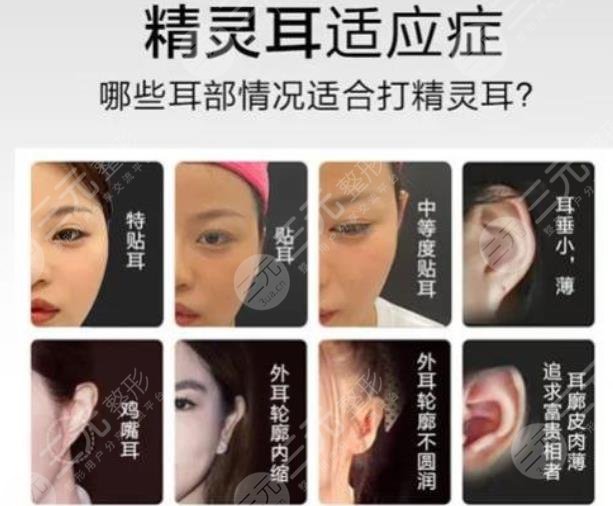 顱耳角在30°-60°之間整形多少錢