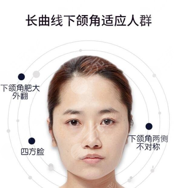 磨骨手術(shù)的風(fēng)險(xiǎn)有多大