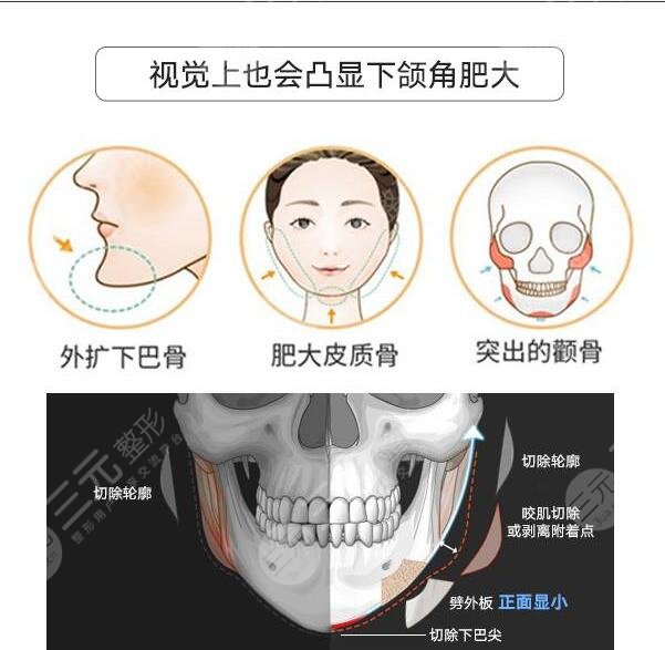 改臉型手術(shù)過程