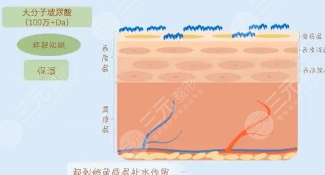 玻尿酸除皺的原理