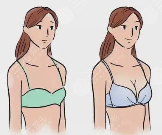 棒棒糖縮胸是什么意思