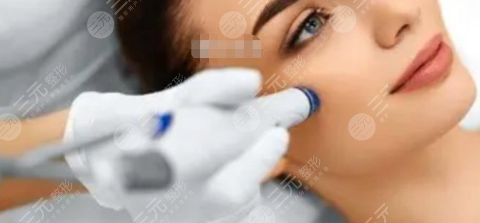 歐洲之星點(diǎn)陣激光