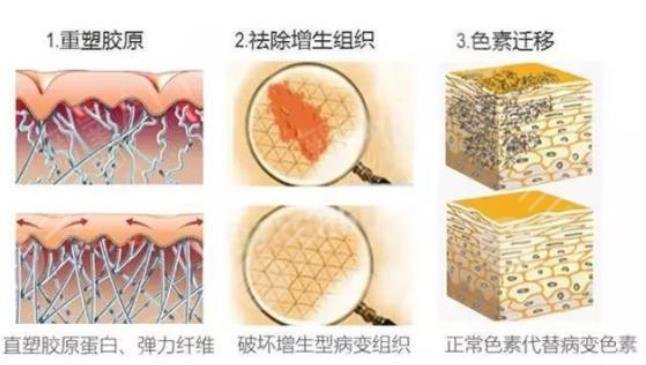 歐洲之星點(diǎn)陣激光