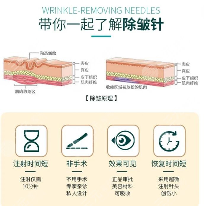 注射除皺果怎么樣