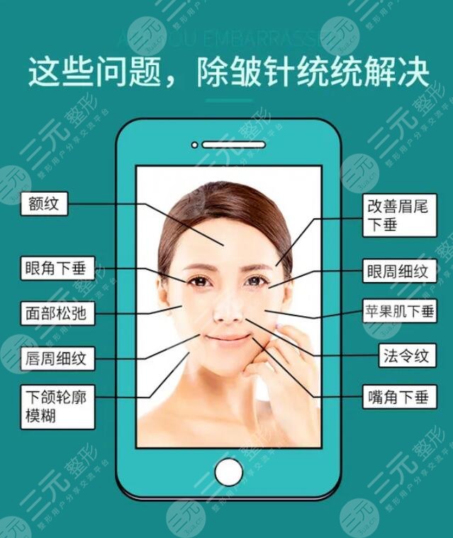 注射除皺的價格