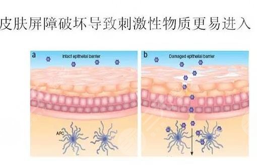 維納斯抗衰儀多少錢(qián)一次?原理_作用功_面部抗衰案例果圖來(lái)襲!