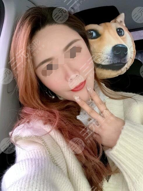 btl射頻緊膚真人案例后2個月