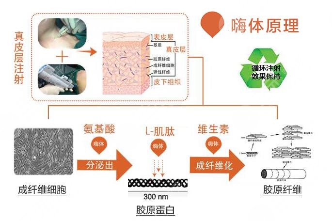 頸部嗨體去皺能維持多久