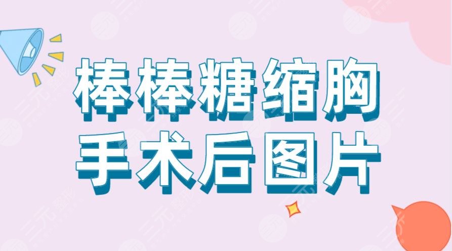 棒棒糖縮胸手術后圖片！手術過程是怎樣的？風險大嗎？附價格表