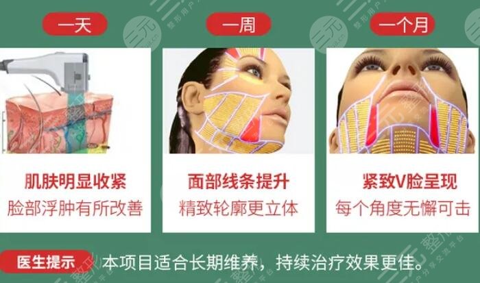 射頻緊膚的作用原理是什么