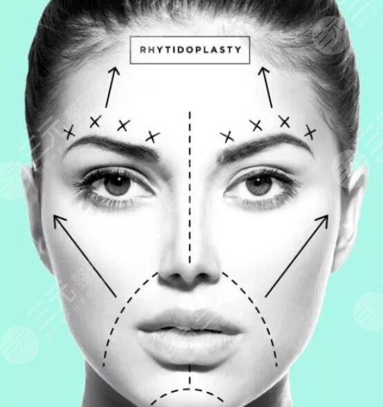 除皺多久可以看見果？除皺抗衰注意事項須知！【除皺案例分享】