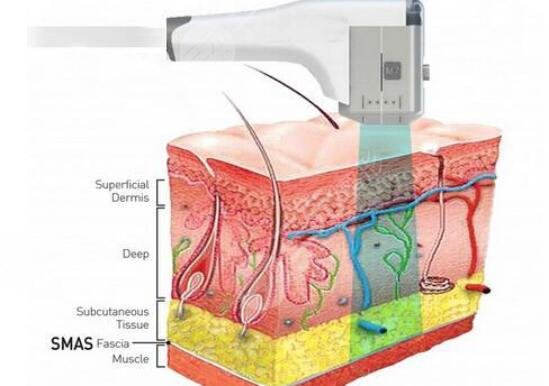 除皺的原理是什么