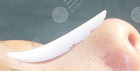 隆鼻時要記住三件重要的事情