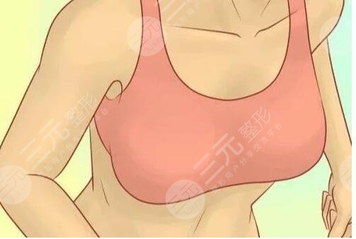 奧諾拉假體隆胸術(shù)后注意事項(xiàng)