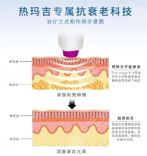 熱瑪吉相關問答科普