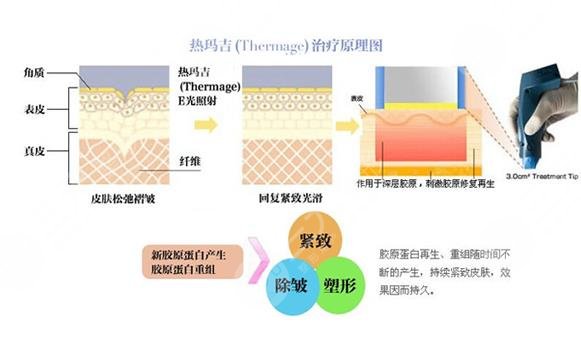熱瑪吉改良果怎么樣