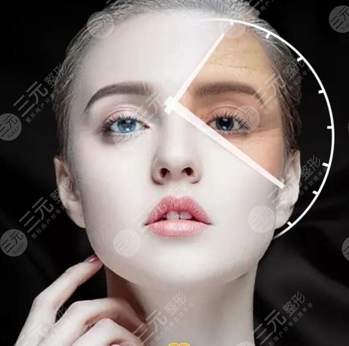 小拉皮手術(shù)可以去淚溝和法令紋嗎？做小拉皮手術(shù)注意事項+案例果