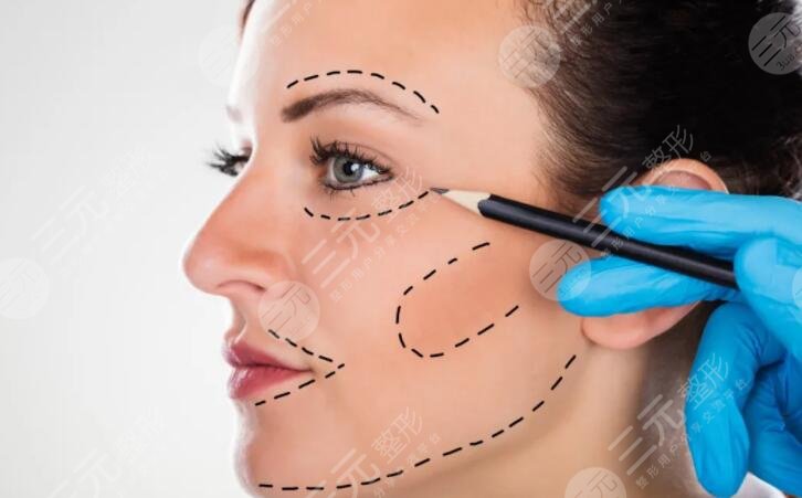 小拉皮手術(shù)的優(yōu)勢有哪些