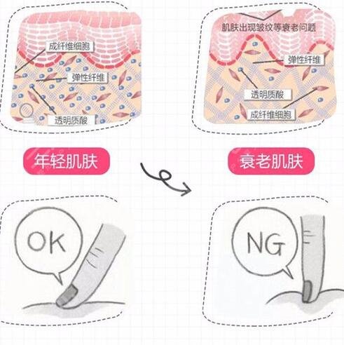 面部拉皮手術的注意事項