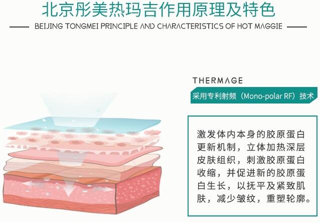 btl射頻緊膚和熱瑪吉區(qū)別