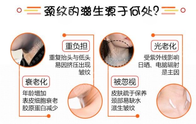 頸飾引起的頸紋