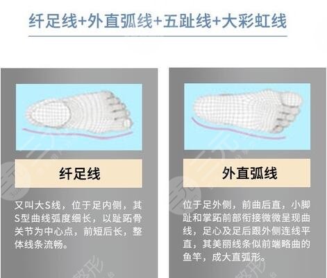 大腳骨外翻怎樣緩解，多少錢？科普講解&術(shù)后注意分享，美足攻略！