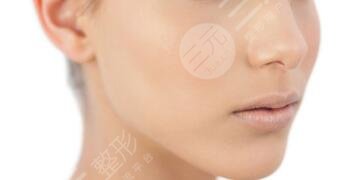 v美骨雕面部抗衰