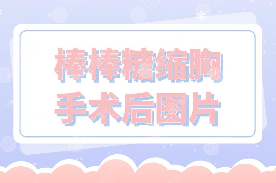 棒棒糖縮胸手術(shù)后圖片分享！附手術(shù)原理介紹+手術(shù)注意事項(xiàng)