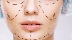 v美減齡面部抗衰果好不好，能維持幾年？功|注意事項|價格公開！