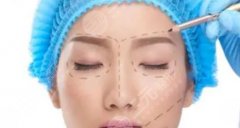 小切口面部抗衰手術(shù)圖片&價格費用分享！一文詳解手術(shù)抗衰的秘密！