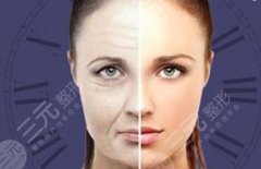 內(nèi)窺鏡除皺術(shù)是拉皮嗎,怎么做，多少錢？抗衰知識全科普，附價格哦！