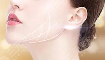 內(nèi)窺鏡除皺