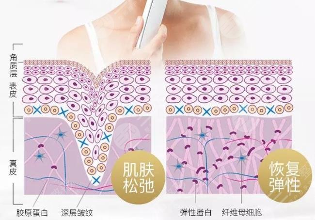 熱提拉的功與副作用