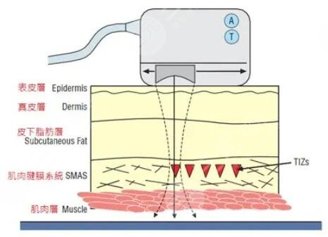 熱拉提的果優(yōu)勢