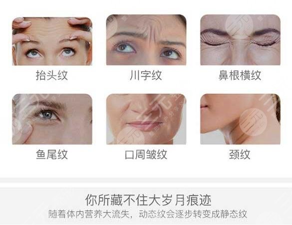 除皺美容手術(shù)方式包括什么