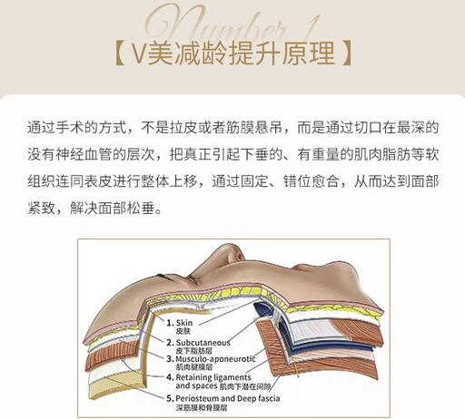 v美減齡面部抗衰術(shù)是怎樣的做法，多少錢？京城抗衰大熱項目科普&價格！