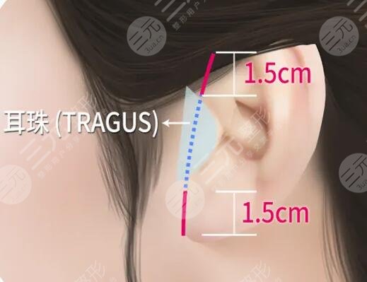 迷你小拉皮能挺多長(zhǎng)時(shí)間