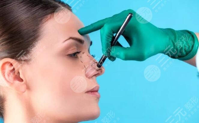 隆鼻假體壽命有多長？假體隆鼻能夠維持多長時(shí)間？假體隆鼻注意事項(xiàng)