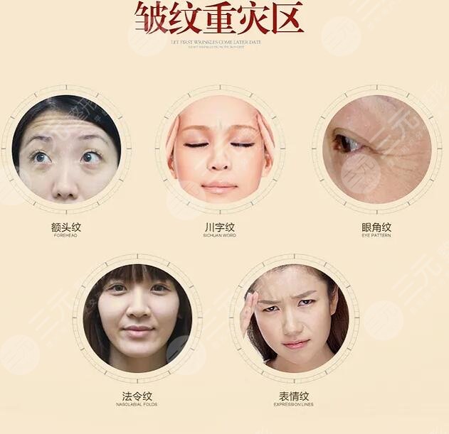 面部除皺術(shù)手術(shù)有哪些風(fēng)險