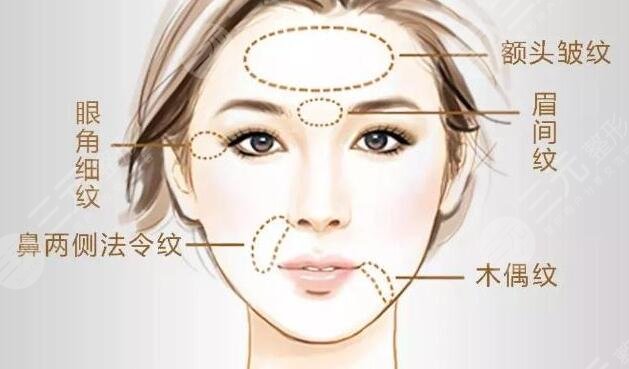 面部皺紋