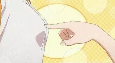 麥格假體可以長期在體內(nèi)嗎