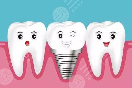 4000元的種植牙好嗎？特點(diǎn)、原理等1分鐘了解！