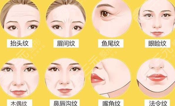 生物注射桿菌除皺