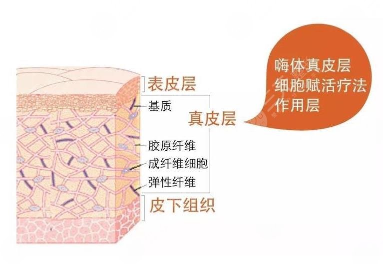 嗨體填充淚溝有沒有副作用?