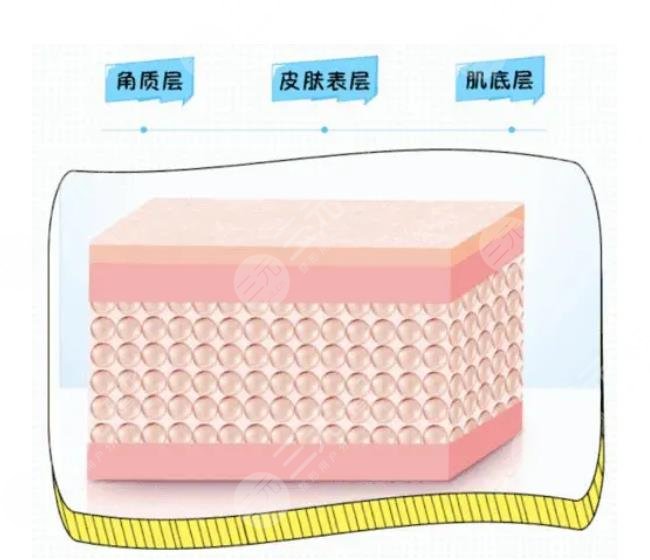 嗨體除皺相關(guān)知識(shí)科普