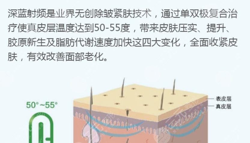 皺紋的深淺程度