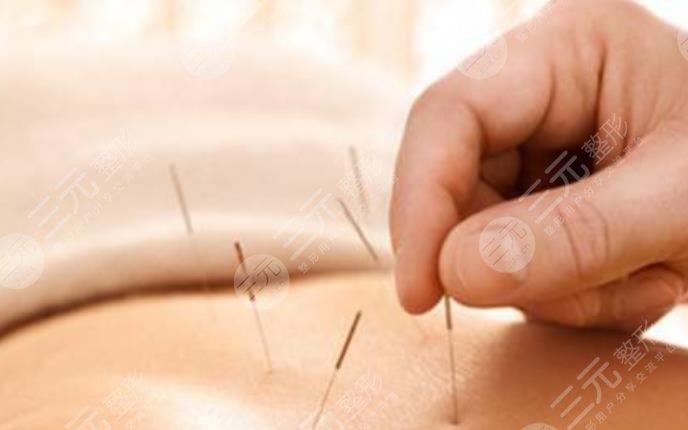 中醫(yī)中醫(yī)減肥